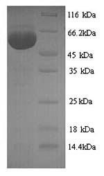 Influenza A virus Nucleoprotein (NP) Recombinant Protein, N-His, aa 1–498, strain A/Puerto Rico/8/1934 H1N1, Influenza A virus (strain A/Puerto Rico/8/1934 H1N1), Yeast, N-terminal 6xHis-tagged, 58.2 kDa, purity >≥ 90% as determined by SDS-PAGE.