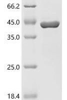 Hydra vulgaris Annexin-B12 (ANXB12) Recombinant Protein - BioCrest Sci
