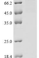 Human Low-density lipoprotein receptor (LDLR), partial Recombinant Protein - BioCrest Sci
