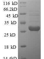 Human U7 snRNA-associated Sm-like protein LSm10 (LSM10) Recombinant Protein - BioCrest Sci