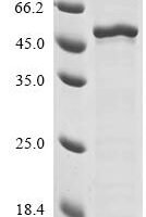Human Forkhead box protein G1 (FOXG1) Recombinant Protein - BioCrest Sci