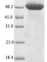 Human Terminal nucleotidyltransferase 4B (TENT4B) Recombinant Protein - BioCrest Sci
