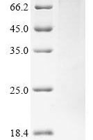 Human CD44 antigen (CD44), partial Recombinant Protein, N-His - BioCrest Sci