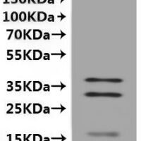 Human STEAP1 protein (STEAP1)-VLPs Recombinant Protein - BioCrest Sci