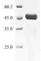 Vesicular stomatitis Indiana virus Glycoprotein G (G), partial Recombinant Protein - BioCrest Sci