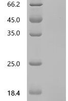 Bovine Transthyretin (TTR) Recombinant Protein, C-His, aa 21–147, Bos taurus (Bovine), Purity ≥90% - BioCrest Sci