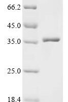 Bombyx mori nuclear polyhedrosis virus Polyhedrin (PH) Recombinant Protein - BioCrest Sci