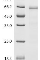Human Ubiquitin-like modifier-activating enzyme 6(UBA6), partial Recombinant Protein - BioCrest Sci