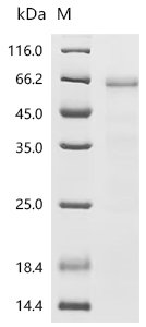 Human Ubiquitin-like modifier-activating enzyme 6(UBA6), partial Recombinant Protein, Homo sapiens (Human), Baculovirus, N-terminal GST-tagged, 70.8 kDa, purity >≥ 85% as determined by SDS-PAGE.