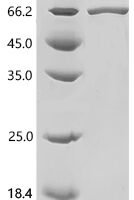 Human Endothelial lipase (LIPG) Recombinant Protein, C-His - BioCrest Sci