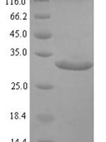 Pongo abelii Transthyretin (TTR) Recombinant Protein - BioCrest Sci