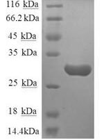 Human Substance-P receptor (TACR1), partial Recombinant Protein - BioCrest Sci