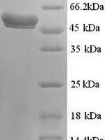 Human N-acetylgalactosamine-6-sulfatase (GALNS) Recombinant Protein, N-His, aa 27–522, Yeast - BioCrest Sci