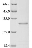 Oncorhynchus mykiss Vitellogenin (vtg1), partial Recombinant Protein - BioCrest Sci