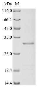 Oncorhynchus mykiss Vitellogenin (vtg1), partial Recombinant Protein, Oncorhynchus mykiss (Rainbow trout) (Salmo gairdneri), E.coli, N-terminal 6xHis-KSI-tagged, 30.1 kDa, purity >≥ 85% as determined by SDS-PAGE.