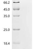 Human Coagulation factor IX (F9), partial Recombinant Protein, N-His, aa 93–171, Yeast - BioCrest Sci