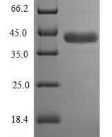 Human Aspartoacylase (ASPA) Recombinant Protein, N-10His/C-Myc, aa 1–313, E.coli - BioCrest Sci