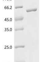 Human UDP-glucuronosyltransferase 1A4 (UGT1A4), partial Recombinant Protein - BioCrest Sci