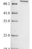Human Cytochrome P450 4F8 (CYP4F8), partial Recombinant Protein, C-His - BioCrest Sci