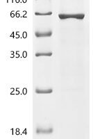 Human Cytochrome P450 11B1, mitochondrial (CYP11B1) Recombinant Protein, C-10His - BioCrest Sci