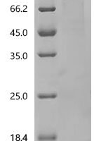 Human Transcription regulator protein BACH1 (BACH1) Recombinant Protein - BioCrest Sci