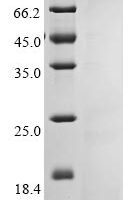 Human coronavirus HKU1 Non-structural protein 4 (4) Recombinant Protein, C-His, aa 1–109, E.coli - BioCrest Sci