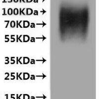 Human Beta-2 adrenergic receptor (ADRB2) (G16R,E27Q)-VLPs Recombinant Protein - BioCrest Sci