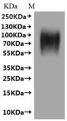 Human Beta-2 adrenergic receptor (ADRB2) (G16R,E27Q)-VLPs Recombinant Protein, Homo sapiens (Human), Mammalian cell, C-terminal 10xHis-tagged(This tag can be tested only under denaturing conditions), 47.8 kDa, purity >≥ 95% as determined by SEC-HPLC.