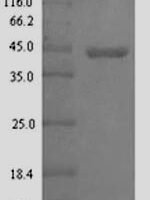 Escherichia coli Glc operon transcriptional activator (glcC) Recombinant Protein - BioCrest Sci
