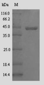 Escherichia coli Glc operon transcriptional activator (glcC) Recombinant Protein, Escherichia coli O6:H1 (strain CFT073 / ATCC 700928 / UPEC), E.coli, N-terminal 6xHis-SUMO-tagged, 44.8 kDa, purity >≥ 90% as determined by SDS-PAGE.