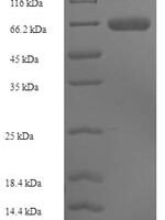 Saccharomyces cerevisiae Alpha-galactosidase 1 (MEL1) Recombinant Protein, N-His-SUMO - BioCrest Sci