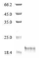 Daboia palaestinae Disintegrin viperistatin Recombinant Protein, N-His-KSI - BioCrest Sci