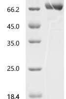 Human Killer cell immunoglobulin-like receptor 3DL3 (KIR3DL3), partial, Biotinylated Recombinant Protein - BioCrest Sci