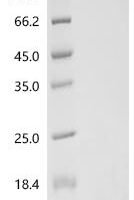 Bacteriophage H30 Shiga-like toxin 1 subunit B (stxB) Recombinant Protein, C-His - BioCrest Sci