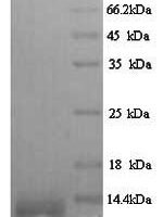 Zaire ebolavirus Pre-small/secreted glycoprotein (GP) Recombinant Protein, N-His, aa 33–364, strain Kikwit-95 - BioCrest Sci