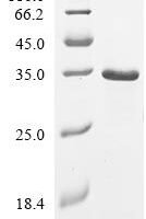 Human Delta like canonical Notch ligand 3 (DLL3) Recombinant Protein - BioCrest Sci
