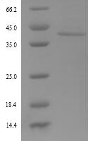 Rat Fetuin-B (Fetub) Recombinant Protein - BioCrest Sci