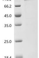 Human Tripartite motif-containing protein 43 (TRIM43), Biotinylated Recombinant Protein - BioCrest Sci