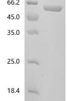 Mouse D-3-phosphoglycerate dehydrogenase (Phgdh) Recombinant Protein - BioCrest Sci