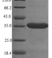 Mouse Sushi domain-containing protein 4 (Susd4), partial Recombinant Protein, N-His - BioCrest Sci