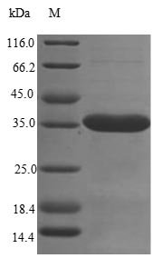 Mouse Sushi domain-containing protein 4 (Susd4), partial Recombinant Protein, N-His, Mus musculus (Mouse), E.coli, N-terminal 6xHis-tagged, 35.5 kDa, purity >≥ 85% as determined by SDS-PAGE.