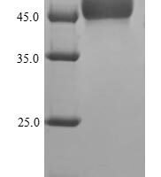 Human MORC family CW-type zinc finger protein 3 (MORC3), partial Recombinant Protein - BioCrest Sci