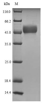 Human MORC family CW-type zinc finger protein 3 (MORC3), partial Recombinant Protein, Homo sapiens (Human), E.coli, N-terminal 6xHis-SUMO-tagged, 48.7 kDa, purity >≥ 90% as determined by SDS-PAGE.