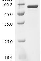 Escherichia coli Alanine--tRNA ligase (alaS), partial Recombinant Protein - BioCrest Sci