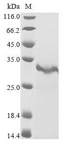 Crotalus atrox Snake venom serine protease catroxase-2 Recombinant Protein, N-His, Crotalus atrox (Western diamondback rattlesnake), Yeast, N-terminal 6xHis-tagged, 27.2 kDa, purity >≥ 85% as determined by SDS-PAGE.
