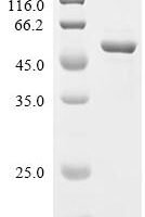 Clostridium pasteurianum Rubredoxin, Biotinylated Recombinant Protein - BioCrest Sci