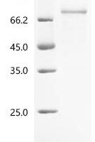 Plasmodium falciparum Circumsporozoite protein (CSP), partial Recombinant Protein - BioCrest Sci