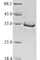 Human Mitogen-activated protein kinase kinase kinase 14 (MAP3K14), partial Recombinant Protein - BioCrest Sci