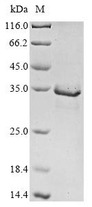 Human Mitogen-activated protein kinase kinase kinase 14 (MAP3K14), partial Recombinant Protein, Homo sapiens (Human), E.coli, N-terminal 10xHis-tagged and C-terminal Myc-tagged, 35.4 kDa, purity >≥ 85% as determined by SDS-PAGE.