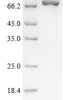 Human Glypican-6 (GPC6) Recombinant Protein, N-His-SUMO - BioCrest Sci